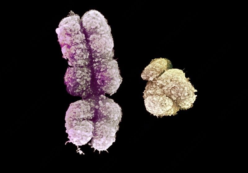 Complete Y Chromosome Sequence Finally Revealed
